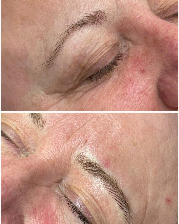 Brow transformation