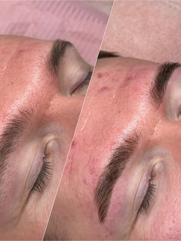 Lash transformation