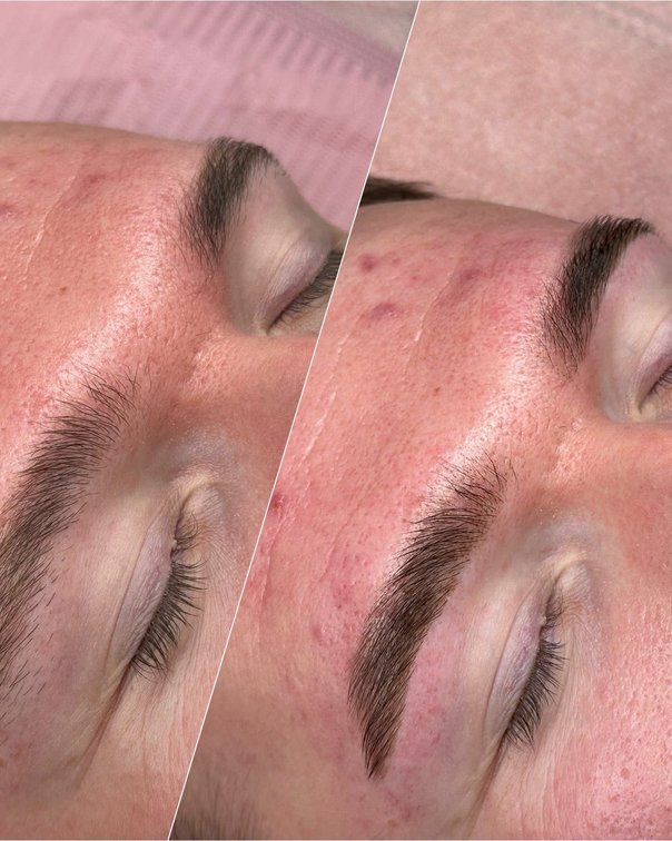 Lash transformation