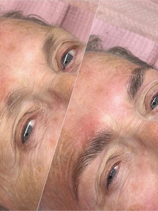 Brow lamination results
