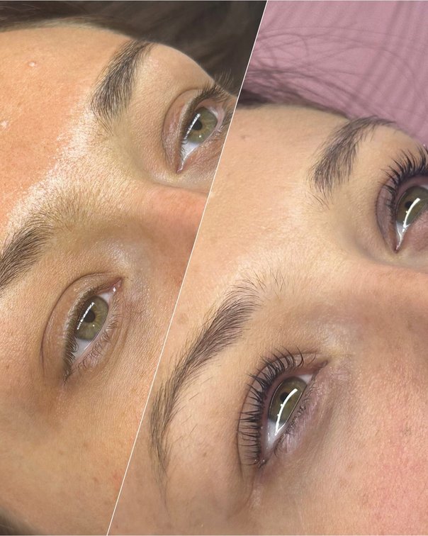 Natural lash enhancement