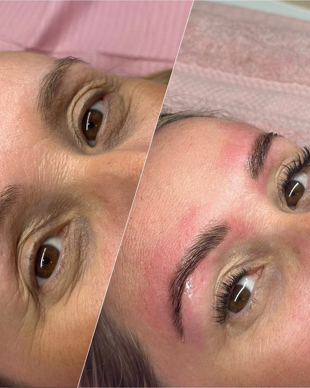 Precision brow architecture